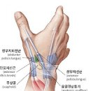 왼쪽 오른쪽 손목 통증 원인 치료방법 이미지