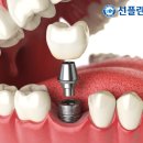 우리플란트치과의원 이미지