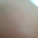 메디뷰 이미지