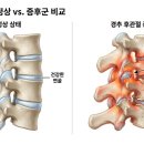 소하신기찬마취통증의학과의원 네이버블로그