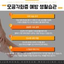 이원행 화접몽한의원 | 일산모공각화증 여름오기전에 치료해요
