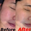 광산-하남-광산-57 | 광주 예비신부 혼주관리 전문 뷰티나게 에스테틱 VVS무결점관리 후기