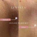 리니 브로우