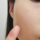 논현피부관리 이미지