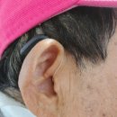 정릉20 | 정릉보청기, 70대 고객님이 비교 후 선택한 실제 후기