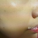 레드피플타투