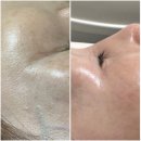 청초바이오 이미지