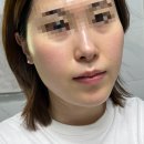 동안 | 엔진리프팅 피부 속근육부터 관리하는 페이스 피트니스 동안 리프팅 후기