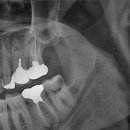 부평센트럴치과의원 이미지