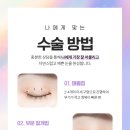 예뻐지는성형외과 네이버블로그