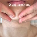 다온스킨 이미지