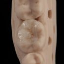 덴탈아트치과기공소 이미지