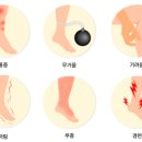 플레이스하지