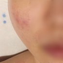 압구정피부관리는 KERASON 케라손관리 전문 제이에스뷰티에서