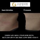 고운빛피부과의원 | 목주름 시술, 정말 필요한가요? 순천 고운빛의원