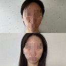 얼굴빚는집 | 아산 얼굴빚는집 "내돈내산" 아산 얼굴 경락 후기