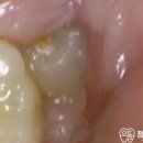 청주으뜸치과의원 이미지