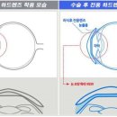 하드렌즈샵안경원 이미지