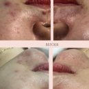 퀸에스테틱 이미지