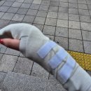 인천터미널정형외과의원 | [일상] 인천터미널정형외과 교상치료 후기 강아지고양이한테 물렸을때 대처법