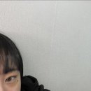 눈밑 마이크로 더멀 피어싱 한 후기
