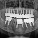 세움치과기공소 이미지