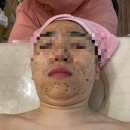 [부산사하] 하단피부에스테틱 뷰티올랑에서 반짝피부 얻고 온 후기