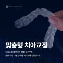 서울시카고치과병원 | 연수구교정치과, 장치 선택부터 치료 과정까지 한 번에 정리해 드립니다.