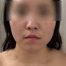 아진메디칼 | 오창 에스테틱 에르벨에스테틱 청주오창점 윤곽관리 후기