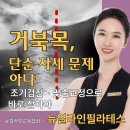 보라매 필라테스! 거북목 교정 회원 후기!