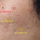 올영같은데서 공용 화장품 겁없이 쓰면 일어나는 최악의일 이미지