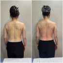 인천부평남초등학교 | 팔뚝살관리 등순환 포티산 스킨멀티플렉스 테라노바 EMS 관리후기