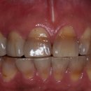 비타민치과기공소 이미지