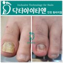 유하루네일