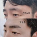 경북종합건재 | 경주 눈썹 문신 리터치 한 달 후기