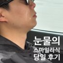 부산큰병원 | 부산 스마일라식 내돈내산 후기! 밝은세상안과 vs 밝은눈안과 비교 선택 &amp; 당일수술 통증·비용 총정리