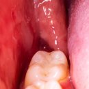 서울돌봄치과의원 이미지