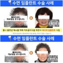 강남심미치과보철과치과의원 이미지