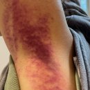 서해프라자 | 부천 상동 피부관리 화이트케어 후기｜서해프라자 위치한 깔끔한 관리샵