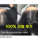 밀스칼프 이미지