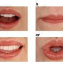 이편한보청기 일산센터 이미지