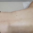 동탄피부관리 맛집 유뷰티 토탈케어에서 전신비만통증관리 후기