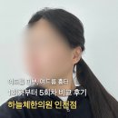 하늘체한의원 | 1회차부터 5회차 비교후기 여드름피부과 하늘체한의원 인천점