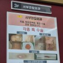 서부연합외과의원 | 대구 서부연합외과 치질 수술 후기 치질 재발 재수술