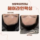 헤어를보람 | 중랑구왁싱 / 면목동왁싱[보람왁싱앤태닝] 웨딩관리 헤어라인+구렛나루왁싱 후기