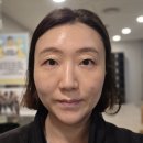 강남역성형외과 올리디아 콜라겐부스터 솔직후기
