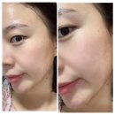 스타메디텍 | 리프팅마스크 눈가주름 듀얼소닉 스프라우트 에너지 마스크팩 으로 겨울 피부관리