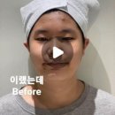 에스테라파 이미지