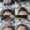 헤드대백프라자지점 | 대전 헤드스파 '네일드블랑 대전탄방점' 코즈미코 헤드스파 후기