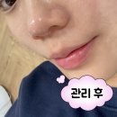 두호고등학교 | 포항피부관리 새미모 포항점 결혼 전 신부관리로 추천